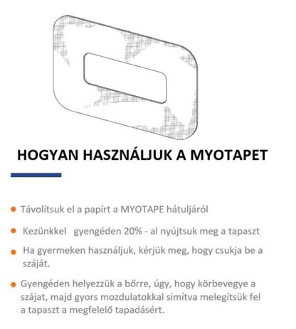 MYOTAPE Szakállasoknak! Orrlégzést támogató szájtapasz - Felnőtt  90 DB - Image 3